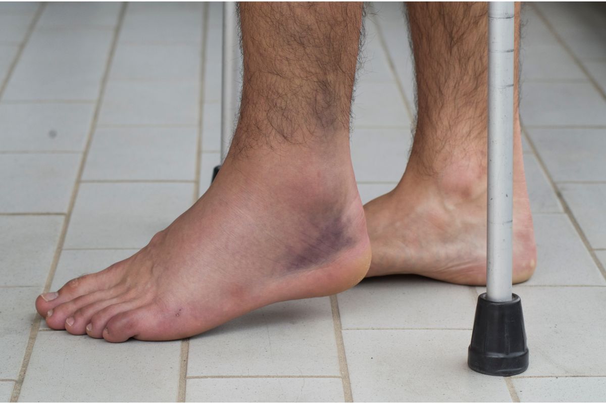 Causes Of Ankle Tendonitis